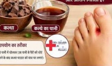 कत्था दूर करेगा फंगल इंफेक्शन की समस्या