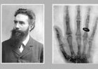 X-Ray की खोज कैसे हुई? जानें शरीर के अंदर देखने वाली इस तकनीक का इतिहास