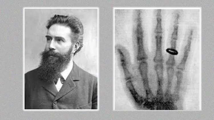 X-Ray की खोज कैसे हुई? जानें शरीर के अंदर देखने वाली इस तकनीक का इतिहास