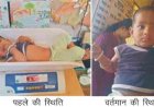 गंभीर तीव्र कुपोषण से सामान्य पोषण श्रेणी में पहुंची याक्षी