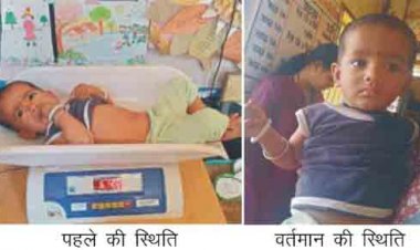 गंभीर तीव्र कुपोषण से सामान्य पोषण श्रेणी में पहुंची याक्षी