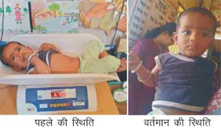 गंभीर तीव्र कुपोषण से सामान्य पोषण श्रेणी में पहुंची याक्षी